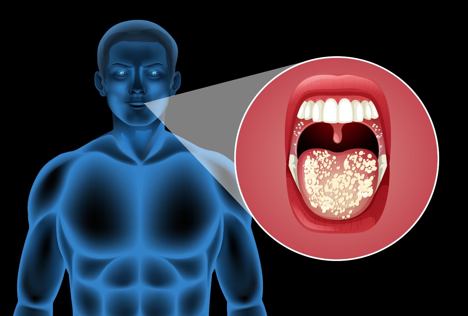 You are currently viewing Stage 1 Oral Cancer Symptoms: 10 Early Warning Signs You Should Never Ignore